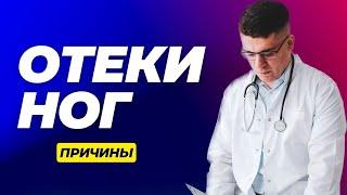 ОТЕКИ НОГ - КАК НАЙТИ ПРИЧИНУ?