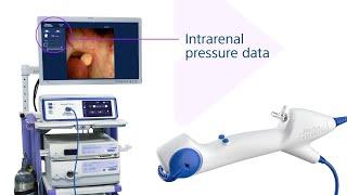 LithoVue™️ Elite Single-Use Digital Flexible Ureteroscope Animation