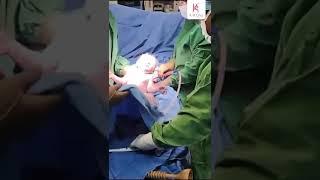 The Hidden Scenes Of Child Birth Nobody Shows You | Kalosa Gynae #shortsvideo #shortsfeed