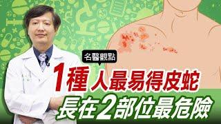 【名醫觀點】天冷當心 皮蛇 纏身！1種人最易得 帶狀皰疹 台大醫師警告長在2部位最危險