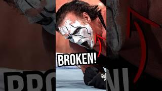 Who Almost Ended STING's Career?! #wwe