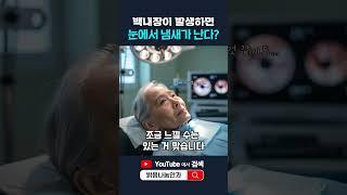 백내장이 발생하면 눈에서 냄새가 난다?