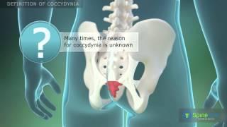 Сoccydynia Definition