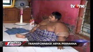 Sempat Alami Obesitas, Begini Transformasi Arya Permana Sekarang...