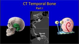 CT Temporal Bone Made Easy (Part 1) - Step by Step Approach