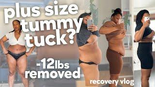 Recovery Weeks 4-7 | Plus Size Tummy Tuck & Breast Reduction