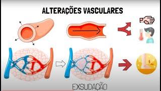 Inflamação Aguda