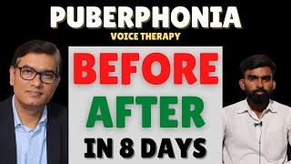 Before-After Puberphonia Speech Therapy | Within 8 Days | #SLPSanjayKumar | Speech Pathologist India