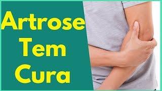 Artrose Tem Cura? Qual o Tratamento Indicado? Clínica de Fisioterapia Dr. Robson Sitta