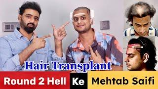 YouTuber Mehtab Saifi Hair Transplant | Round 2 Hell & 5 Second Channel #YouTuber Hair Transplant