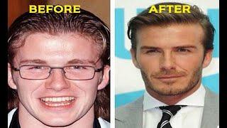 Celebs Before And After - Fast And Curious