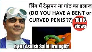 लिंग में टेढ़ापन या गांठ का इलाज (peyronies disease).Curve or bent penis treatment.