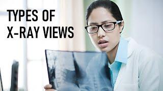 Different Types of Chest X-ray Views