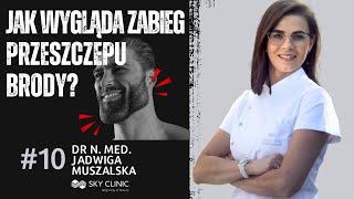 Przeszczep brody - wszystko, co musisz wiedzieć | Wywiad z Dr n. med. Jadwigą Muszalską | Sky Clinic