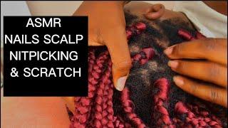 ASMR|Part 2: Nails Braids Scalp Scratch| Tingles | No talking | Nitpicking