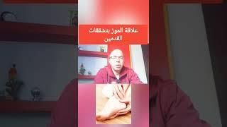 كيف يؤثر الموز علي نعومة الكعوب #افكار_صحية #علاج #التشققات