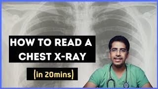 How to read a chest X-ray (in 20 mins) !