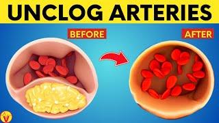 Top 11 Foods to Clean Your Arteries And Prevent Heart Attacks | VisitJoy