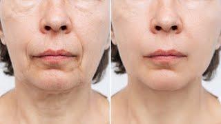 Face Lift, Facial Toning, and Skin Lightening (morphic Field)