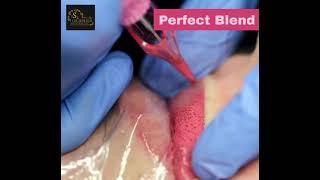 Lips colour treatment in zirakpur | The Skin Zeal | 72-93-93-93-26