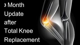 3 Month Update on my TOTAL KNEE REPLACEMENT! #kneereplacementrecovery #update