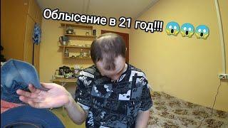 Облысение в 21 год!! Почему не растут волосы? (Моя История)