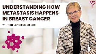 How Does Breast Cancer Metastasis Happen and How Can You Treat it?