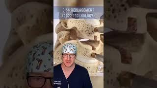 Disc Replacement Technology in 2022 (Texan Spine Surgeon Explains) 