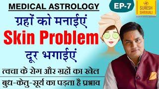 Medical Astrology | जानिए कुंडली मे कौनसे ग्रह देते हैं Skin Problem व उपाय SURESH SHRIMALI | Ep-7