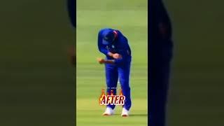 Rohit Dislocated Shoulder ||Rohit sharma status||#shorts #rohitsharma #status