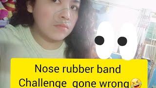 Nose rubber band challenge gone wrong  ll Mhar's Quiñonez