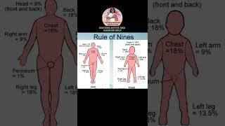 Rule of Nine of Burn #nursingnotesanddiagramhelp #burn #ruleofnine