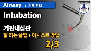 A22 [기도관리] 5. 기관내삽관- 잘하는꿀팁/어시스트 (2/3) ... [Airway management] Intubation