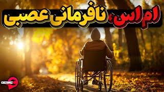 ام اس، بیماری التهابی تهاجم به سلول‌های عصبی و خبر های خوش درباره مداوای آن