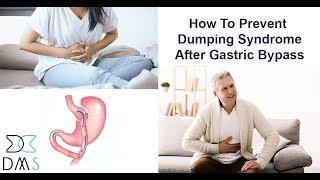 How to Prevent Dumping Syndrome After Gastric Bypass Surgery