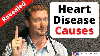 What REALLY Causes HEART DISEASE ?? Revealed - 2024