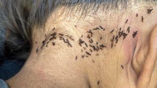 Remove hundred lice from black hair - Pick out all thousand lice from her long hair