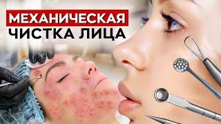 ЭТА процедура делает кожу ЧИСТОЙ! / Что такое механическая чистка лица?