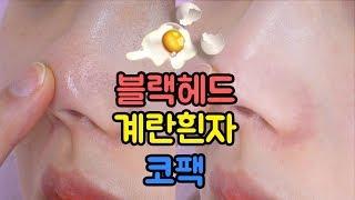 돈안들이고 계란 흰자로 집에서 코팩 만들기 !! 블랙헤드 /피지 제거하는 방법/ 코 모공 줄이는법 Black head remover┃소정 Sojeong