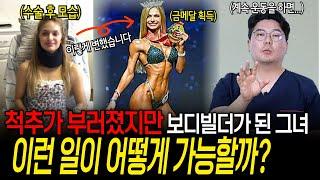 운동하다 척추가 부러졌지만 보디빌더가 된 그녀, 이런 일이 가능할까? | 의학 전문채널