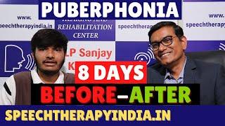 Before-After Puberphonia Speech Therapy | Within 8 Days | #slpsanjaykumar | Speech Pathologist India