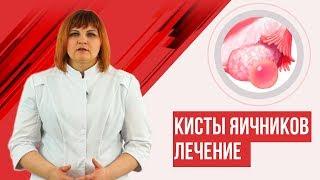 Киста яичника. Лечить? Или сама исчезнет?