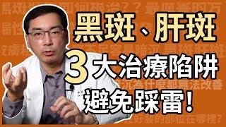 治療黑斑、肝斑有三大陷阱，想避免踩雷不可不知！皮膚科林政賢醫師告訴你治療肝斑三個容易忽略的細節！