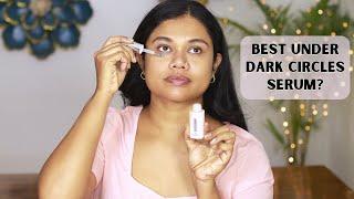 7 Days Dark Circles Removal Challenge | Sushmita's Diaries