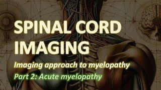 Imaging of the Spinal Cord (2): Acute myelopathy (MS, NMOSD, MOGAD, spinal cord infarction...47)