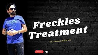 Freckles Treatment | Dr. Arshad Skin Specialist | Doctor