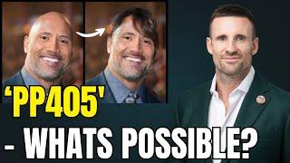 Hair Loss Doctor Reacts: Is PP405 the Real Cure for Baldness — or Just Hype?
