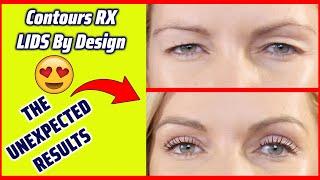 Do Contours RX LIDS Work? Change The Way You Look With Contours RX Eyelids - Eyelids Reviews