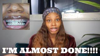 Almost The End!! | Braces Update | Starring Shameka