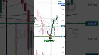 This is how we find Support and Resistance zones  for PROFITABLE TRADES 